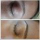 Epilation sourcils